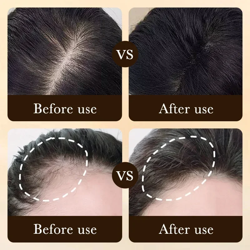 Biotin Fast Hair Growth Oil Pr - огляд і ціна Epidermal Growth Factor