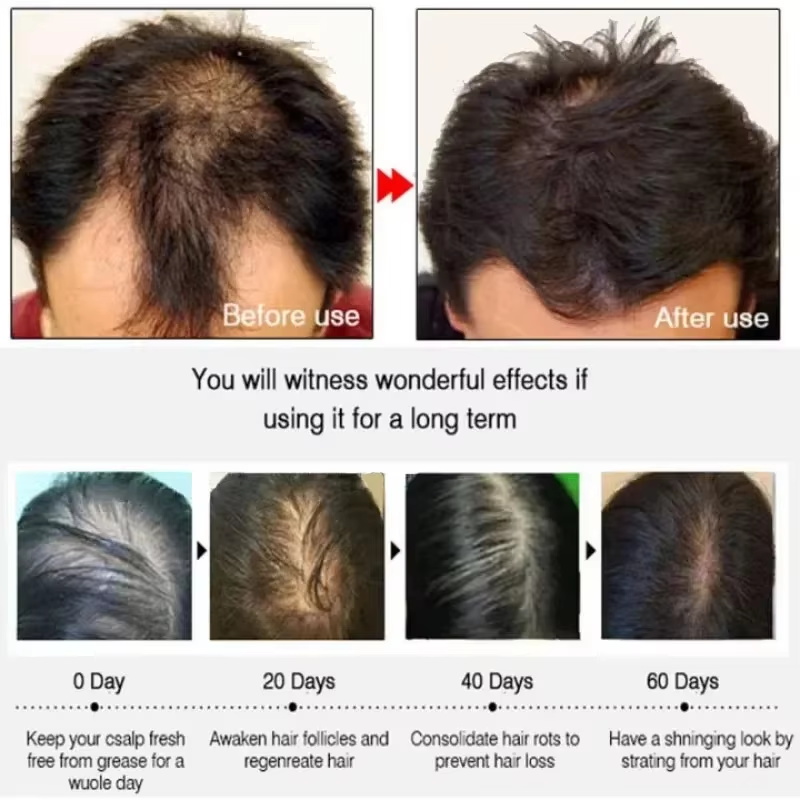 Hair Growth Serum 7 Days Fast  - огляд і ціна Epidermal Growth Factor
