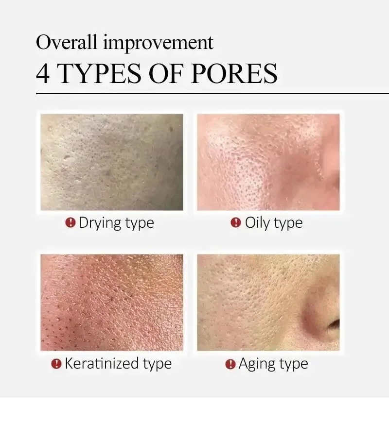 Centella Asiatica Shrink Pores - огляд і ціна Luxury Skincare Korea