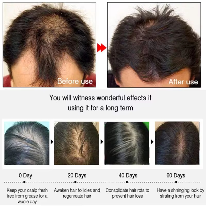 Fast Ginger Hair Growth Spray  - огляд і ціна Epidermal Growth Factor